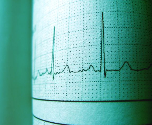 ECG screen