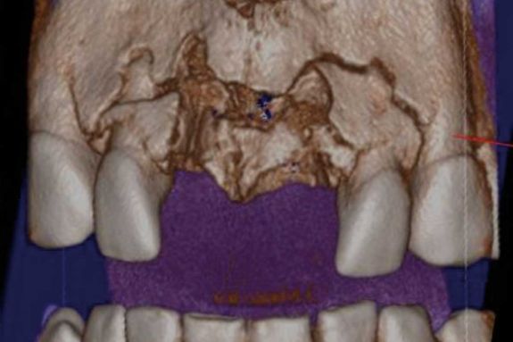 facial imaging