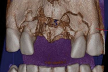 facial imaging