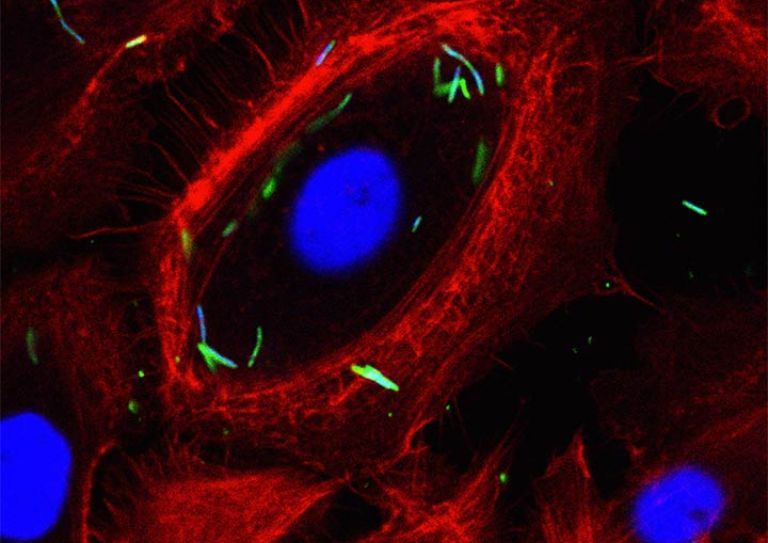 Intracellular localization of Fusobacterium nucleatum in GECs. Immunofluorescence confocal micrograph GECs infected with F. nucleatum (MOI of 100) for 1 h. The single optical section through the middle of the host cell confirms the intracellular localization of the bacteria. Fixed GECs were stained with phalloidin-tetramethylrhodamine B isothiocyanate (red) to show actin filaments, and anti-F. nucleatum antibody (green). Bar represents 20 µm.