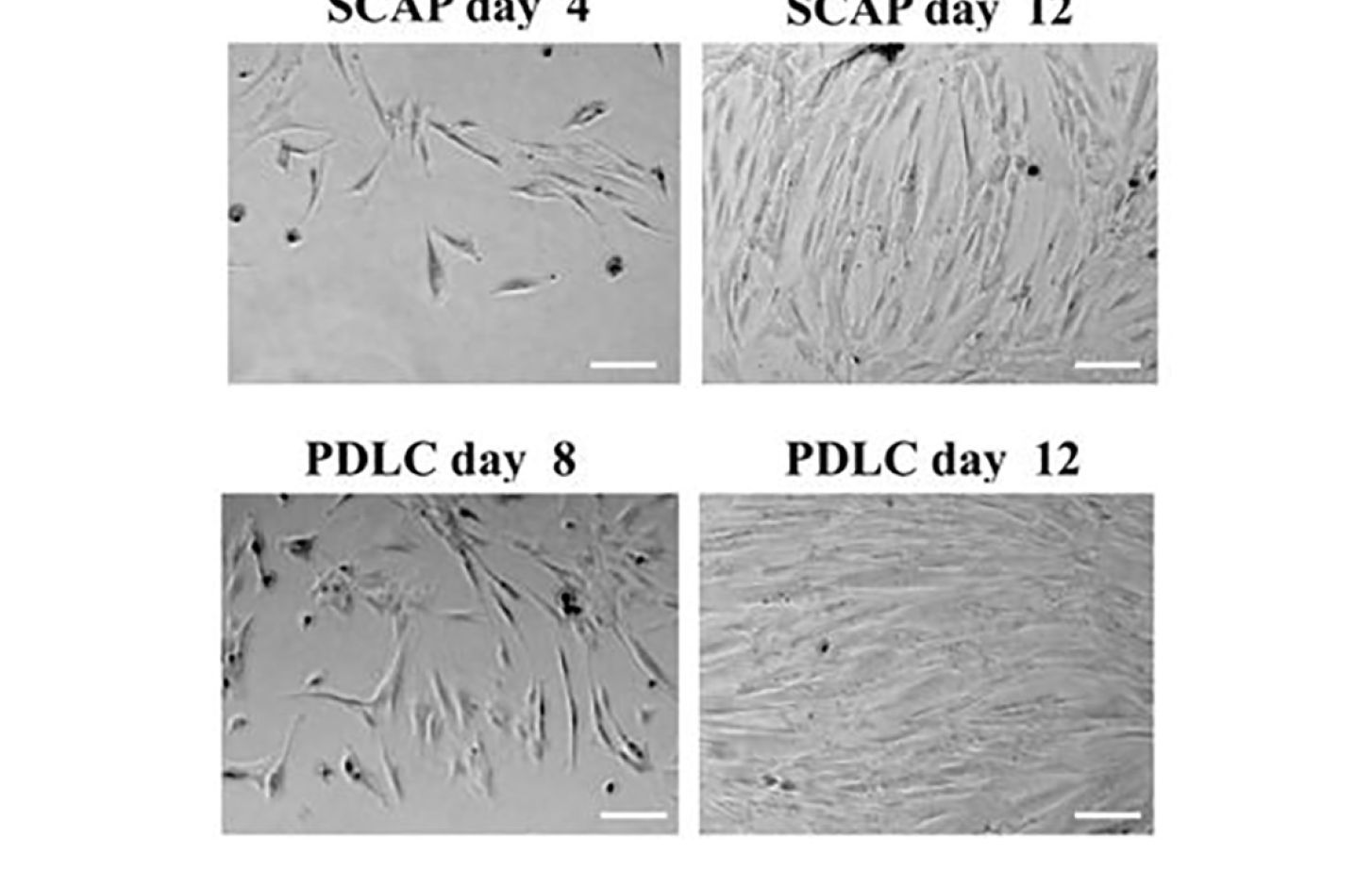 Generation of fibroblast colonies from single cells after 8 to 12 days of culture. Representative phase contrast microscopic photographs of generation and expansion of SCAP and PDLC. Cells have elongated shapes and grow attached to substrata. Scale bar, 25 μm.