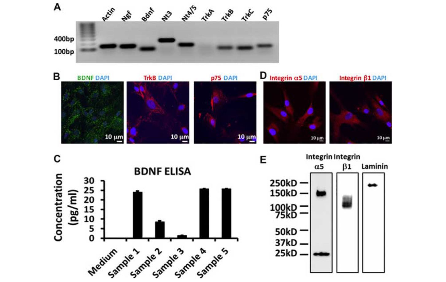 Expression of neurotrophic factors and cell adhesion molecules in human. DPSCs (A) Expression of the neurotrophic factors Ngf, Bdnf, Nt3, Nt4/5, their receptors TrkB, TrkC, and the co---receptor p75 in the human DPSCs. 10% samples were loaded for internal control actin (B) Cellular localization of BDNF, its receptor TrkB, and co---receptor p75 in DPSCs (C) ELISA of the secreted BDNF from DPSCs in the culture medium (n = 5) (D) immunofluorescent staining and (E) Western blotting of integrin a5, integrin b1 a