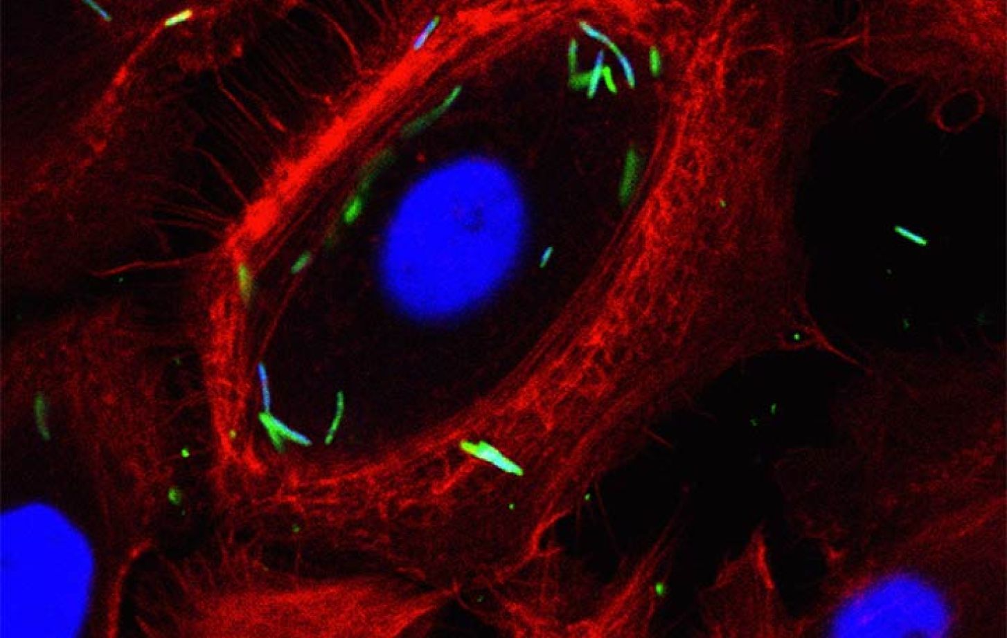 Intracellular localization of Fusobacterium nucleatum in GECs. Immunofluorescence confocal micrograph GECs infected with F. nucleatum (MOI of 100) for 1 h. The single optical section through the middle of the host cell confirms the intracellular localization of the bacteria. Fixed GECs were stained with phalloidin-tetramethylrhodamine B isothiocyanate (red) to show actin filaments, and anti-F. nucleatum antibody (green). Bar represents 20 µm.