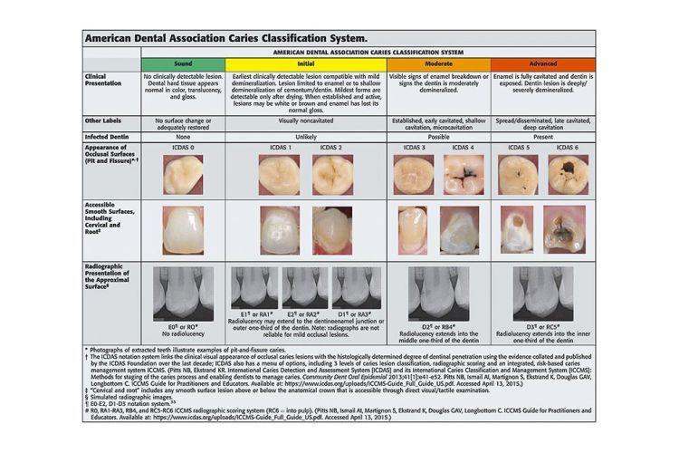 American Dental Association caries classification system.