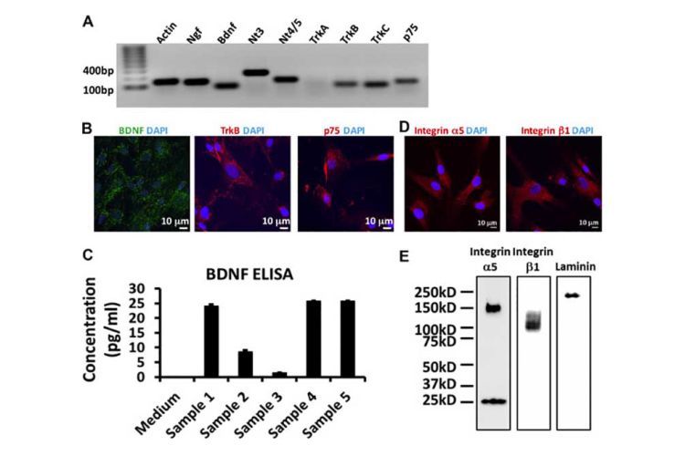 Expression of neurotrophic factors and cell adhesion molecules in human. DPSCs (A) Expression of the neurotrophic factors Ngf, Bdnf, Nt3, Nt4/5, their receptors TrkB, TrkC, and the co---receptor p75 in the human DPSCs. 10% samples were loaded for internal control actin (B) Cellular localization of BDNF, its receptor TrkB, and co---receptor p75 in DPSCs (C) ELISA of the secreted BDNF from DPSCs in the culture medium (n = 5) (D) immunofluorescent staining and (E) Western blotting of integrin a5, integrin b1 a