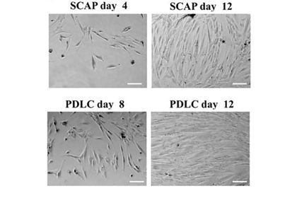 Generation of fibroblast colonies from single cells after 8 to 12 days of culture. Representative phase contrast microscopic photographs of generation and expansion of SCAP and PDLC. Cells have elongated shapes and grow attached to substrata. Scale bar, 25 μm.